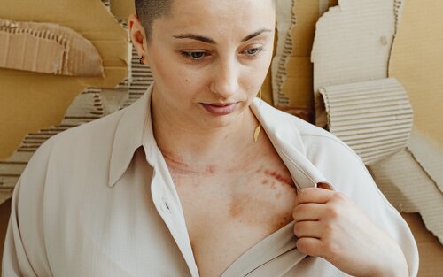 Жінка зі шрамами | © Pexels