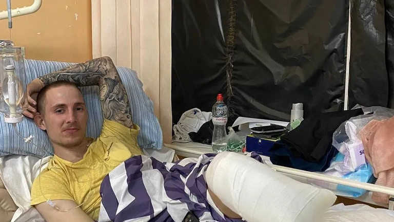 Олександр Будько на лікарняному ліжку | © Instagram Олександра Будька