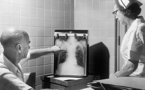  Лікарі переглядають рентген хворого на туберкульоз | © Unsplash