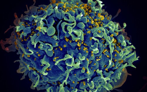  ВІЛ, вірус СНІДу (жовтий), інфікує клітину людини | © Unsplash